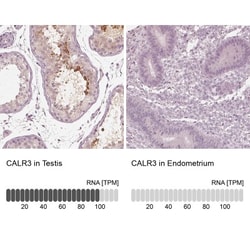 Calreticulin-2/CALR3 Antibody, Novus Biologicals 0.1mL; Unlabeled:Antibodies,